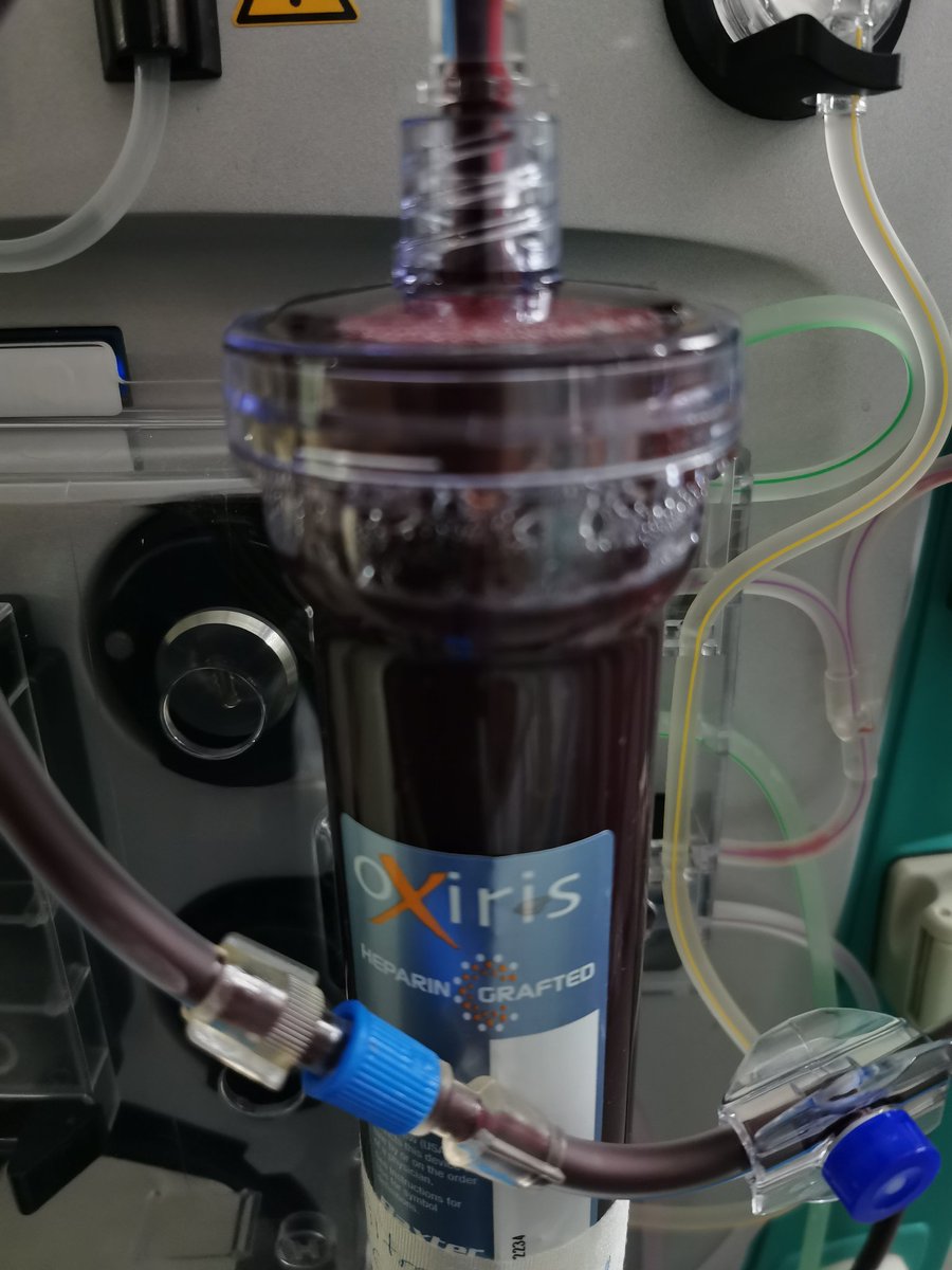 yasserman93's tweet photo. "Te parece que somos riicoooos" Después de 3 filtros coagulados de #Oxiris en la #TRRC de #PRISMAFLEX a ver si este sí amarra jajaja. https://t.co/3ByrPgK3mj