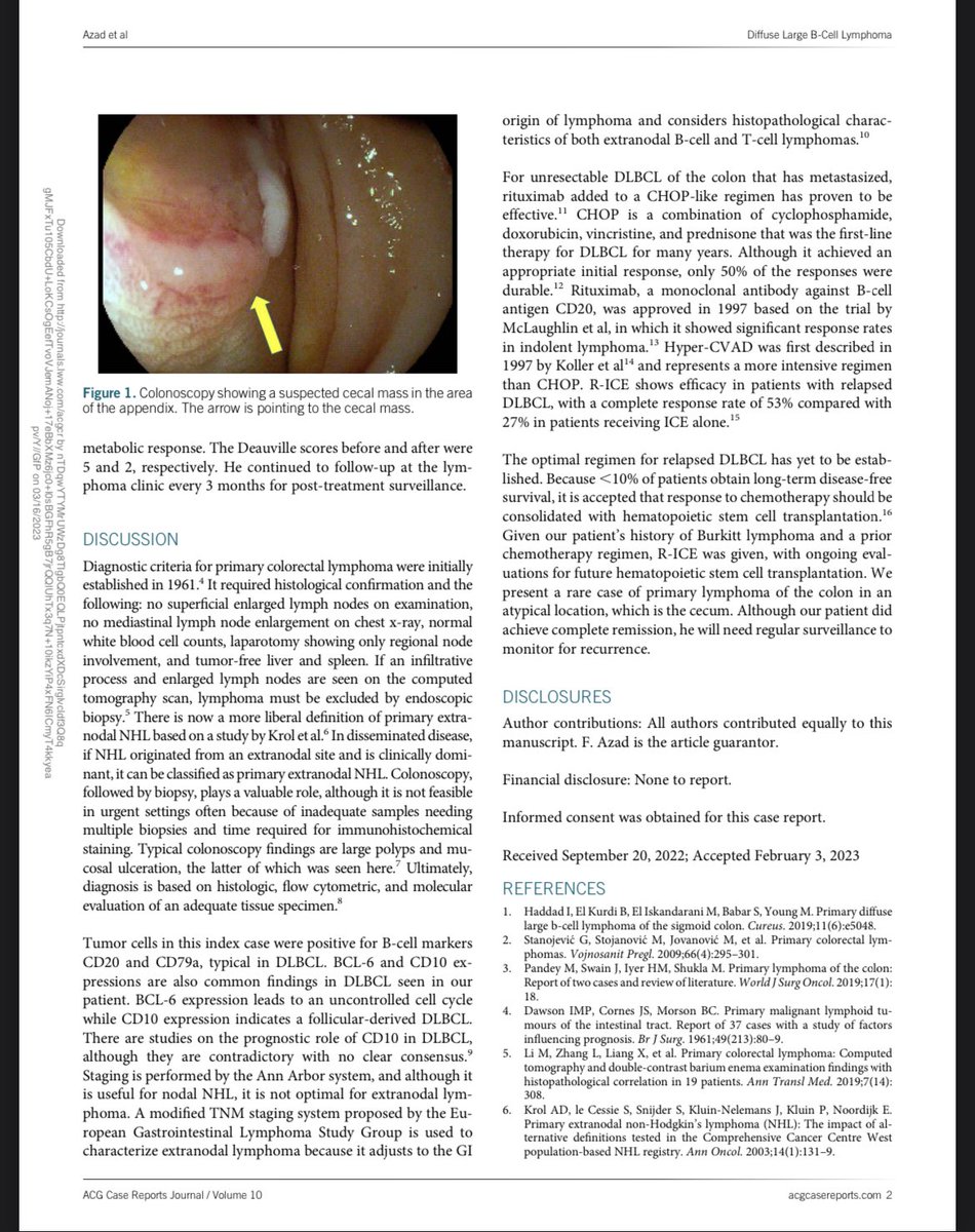 🚨 Delighted to have worked with these stellar GI and oncology enthusiasts to create this fine 📝 on DLBCL of the cecum in @ACGCRJ ‼️

@do_azad @murad_aliMD @muddasir_ayazMD  

Special thanks to @KhushbooSGala @SempokuyaMD @NickMcDonaldMD for their edits👏 #GITwitter #OncTwitter