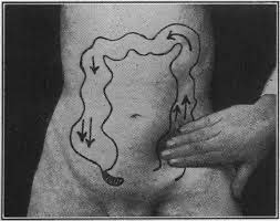 FaisalGhani_'s tweet photo. This maneuver elicits tenderness in the right lower abdomen, because contents of the left lower abdomen are shifted upon application of pressure, further irritating the inflamed peritoneum, and not because of retrograde passage of gas, as erroneously depicted in this picture. https://t.co/EBPqfczs8y
