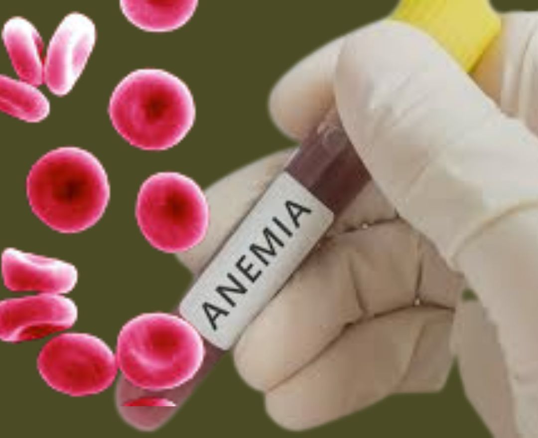points_new's tweet photo. ANEMIA | MOST DANGEROUS DISEASE IN THE WORLD
https://t.co/ThU07twnHD
..........
#anemia #diabetes #iron #irondeficiency #health #cancer #insomnia #anemiaproblems #covid #darahtinggi #jusdrinks #stroke #herbal #healthylifestyle #hipertensi #sembelit #kolesterol #detox #spirulina https://t.co/2t8ydm9gd1