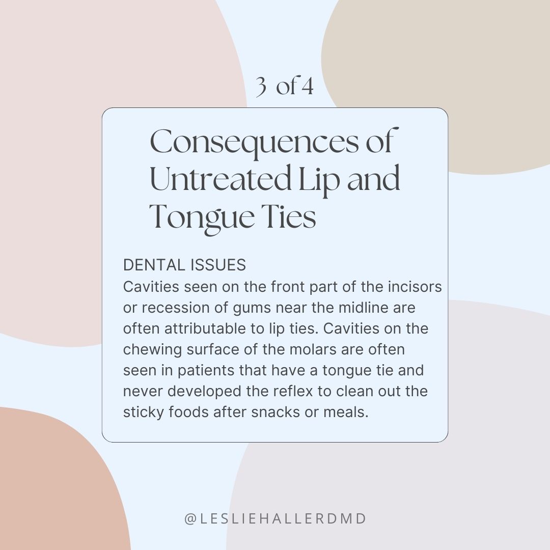 Consequences of Untreated Lip and Tongue Ties - Part 3 of 4 is about dental issues. Stay tuned for the next part, and share this post with someone you care about 💙

#liptie #liptied #tonguetie #tonguetierelease #consequence #consequences #miamidoctor