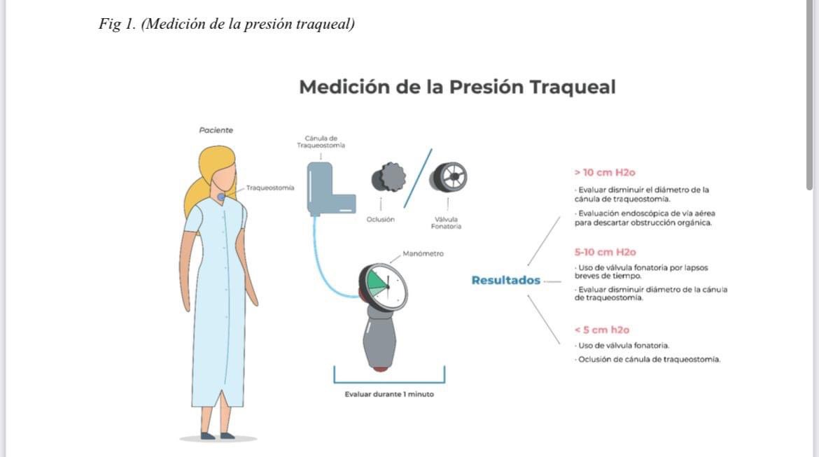 BenitoParraMal1's tweet photo. Les comparto nuestra nueva publicación. Progresión en el paciente con traqueostomia, desde la VM hasta la decanulación. @chileanestesia Muchas gracias Dra 🙏 https://t.co/l8BuW6fhro