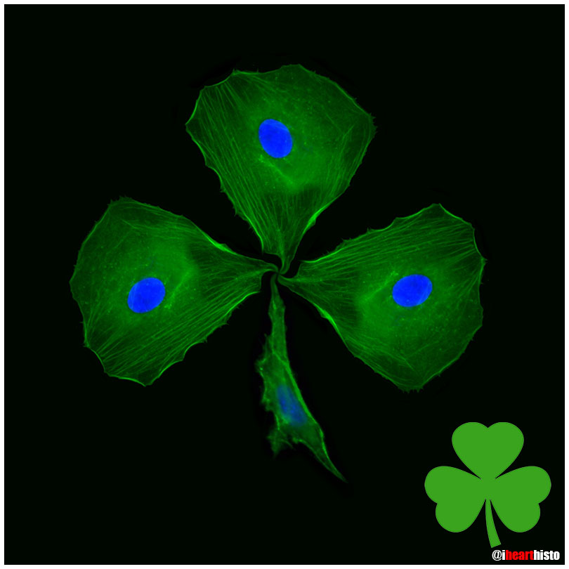 ☘️ Shamrock Fibroblasts ☘️

For each petal on the shamrock
This brings a wish your way
Good health. Good luck. Happiness.
For today and every day

Happy St Patrick’s!

Artistically arranged fibroblasts stained to show the actin cytoskeleton &amp; nucleus 
#histology #science #anatomy