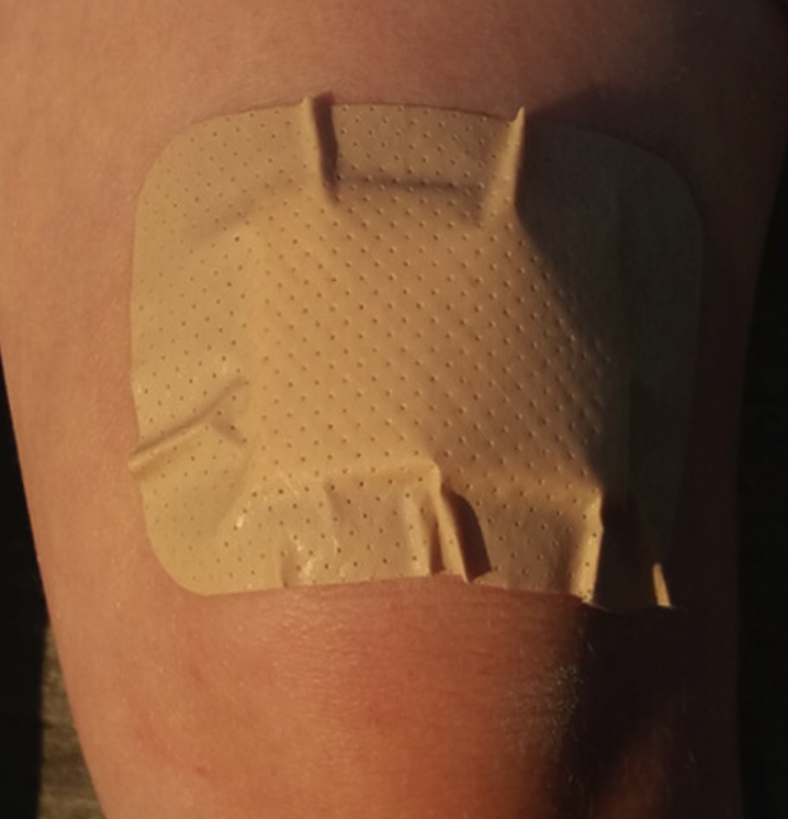 Band-aids are flat, but knees are curved; this geometric incompatibility means blisters often form, but when depends on how bendable the band-aid is, as shown in this new study pnas.org/doi/10.1073/pn…