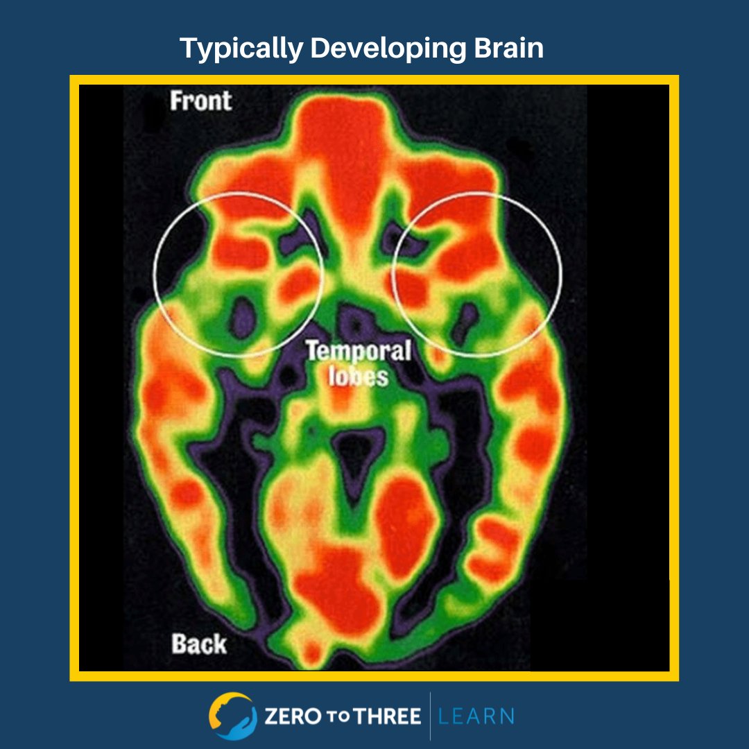 ZEROTOTHREE's tweet photo. Early childhood providers can learn more about brain development and how toxic stress can negatively influence the brain development of very young children.  Register for The Growing Brain Training-of-Trainers: https://t.co/o30NlGIkMn

#BrainAwarenessWeek #ProfessionalDevelopment https://t.co/KjV8OkzehH