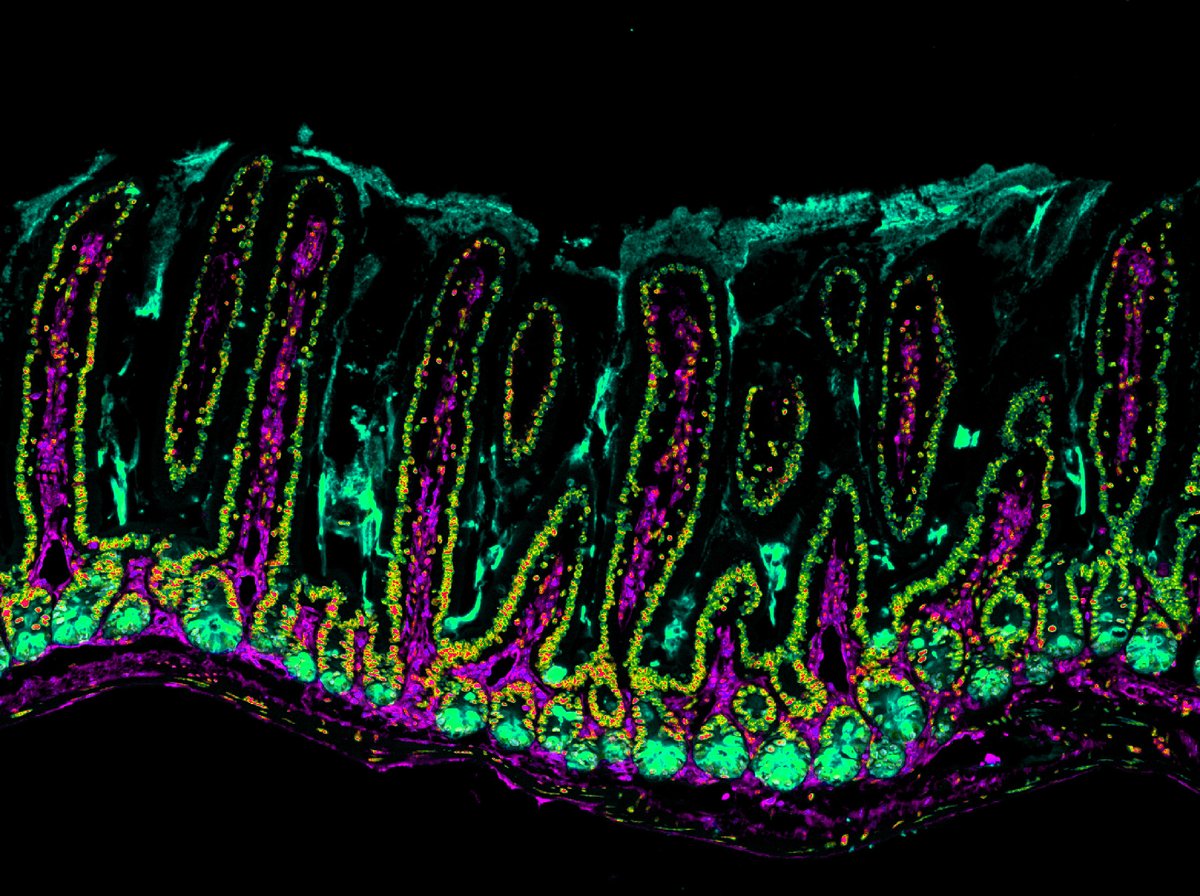 micromindy's tweet photo. Happy #StPatricksDay2023 and #FluorescenceFriday! May the #luck of the Irish be with your experiments today 😆#intestine #mucusmatters #panethcells #gut #bioart #sciart #underthemicroscope https://t.co/EJEaBUvO0i