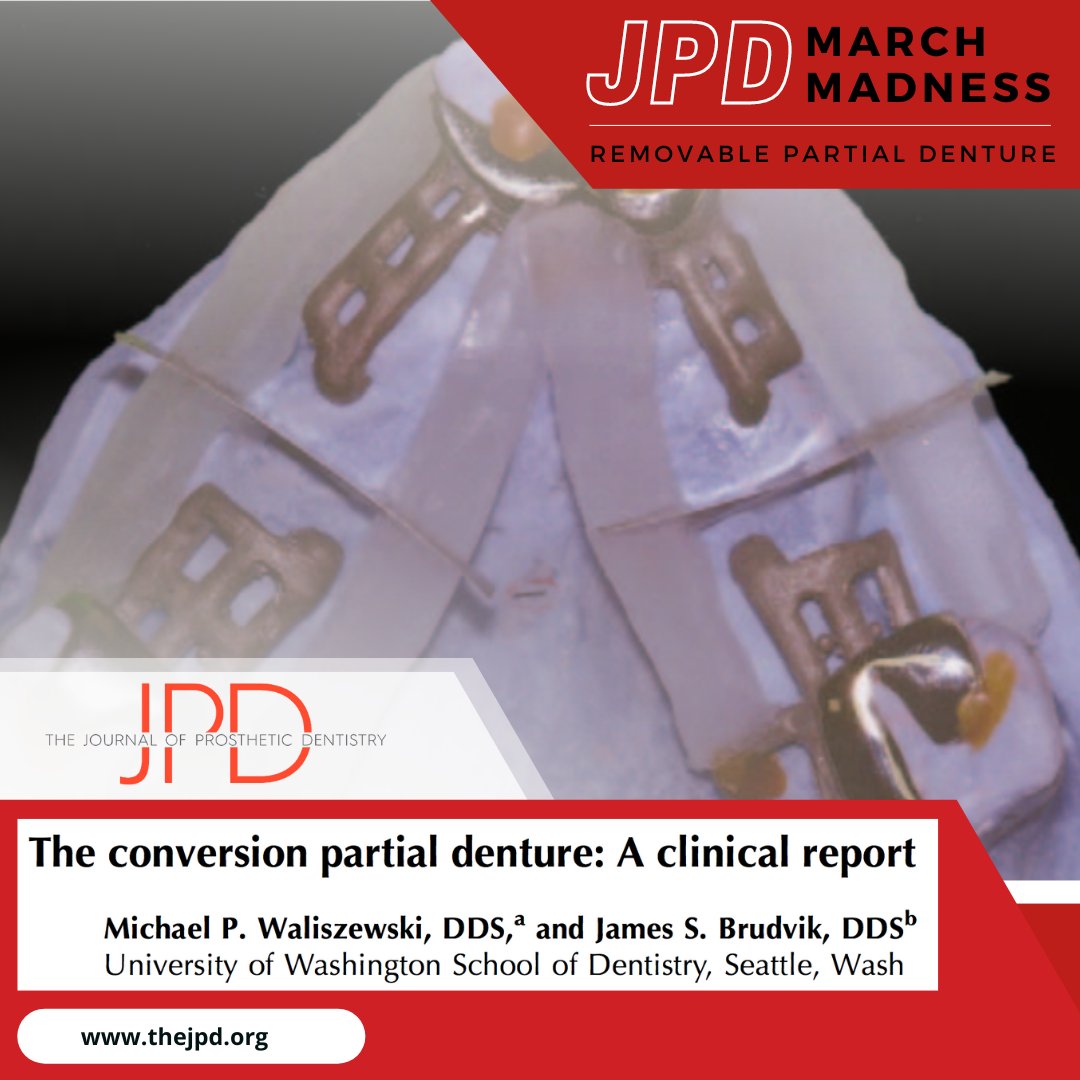 JPDentistry's tweet photo. #removablepartialdenture round – An analog approach is used to fabricate a long-term transitional #RPD that accommodates for the terminal #dentition that maintains the metal plate and clasp assembly on #abutmentteeth: https://t.co/nNUn7vrTgL
#2023theJPDMarchMadness https://t.co/nwFd1zbqpV