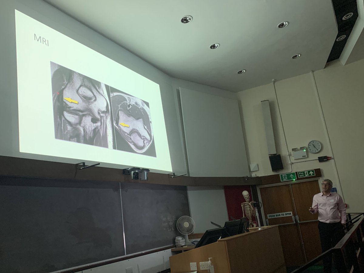 RUHHandTherapy's tweet photo. A great session on investigations of the elbow, covering trauma and degenerative conditions #theelbow #trainingday #CPD https://t.co/LP2xVotEFc