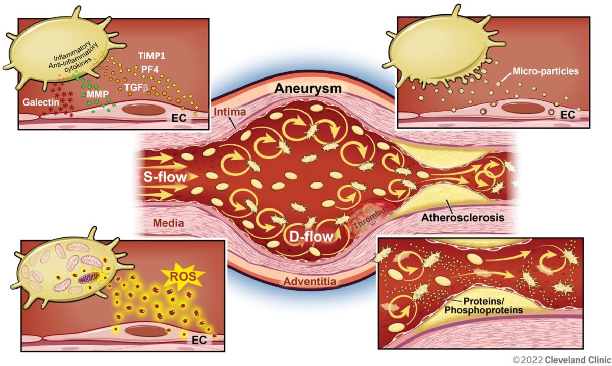 Added to the #platelets *must read* list: "Platelets at the Vessel Wall in Non-Thrombotic Disease" from <a href="/2Scottish/">Scott Cameron 🏴󠁧󠁢󠁳󠁣󠁴󠁿🇺🇸🫀🩺📟🔬🧫🧬🥋</a>  ahajournals.org/doi/10.1161/CI…