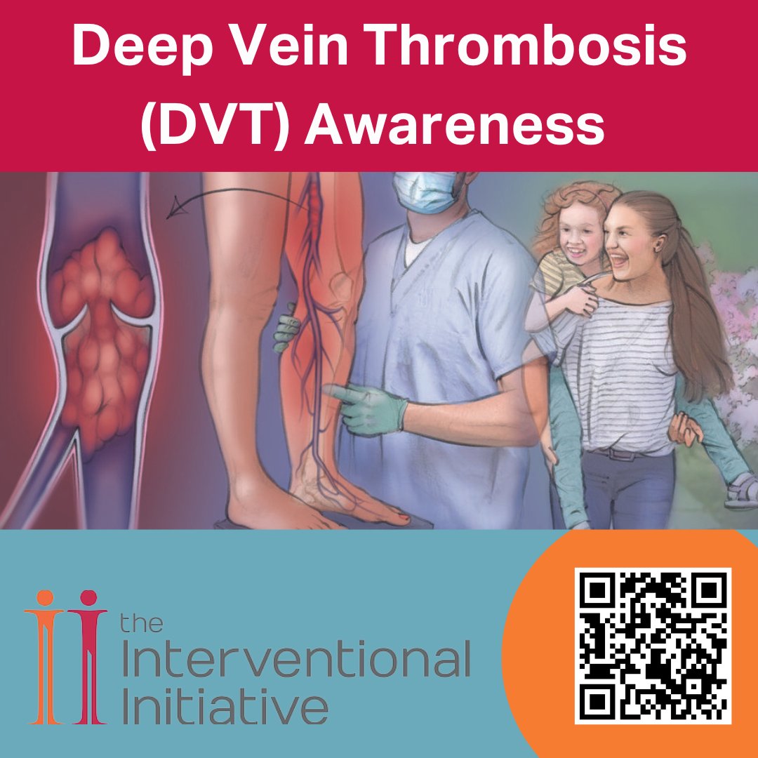 Interventional2's tweet image. If a #bloodclot in the legs called a #DVT travels to the lungs, it can cause a life-threatening #pulmonaryembolism. A #MIIP can save your life.