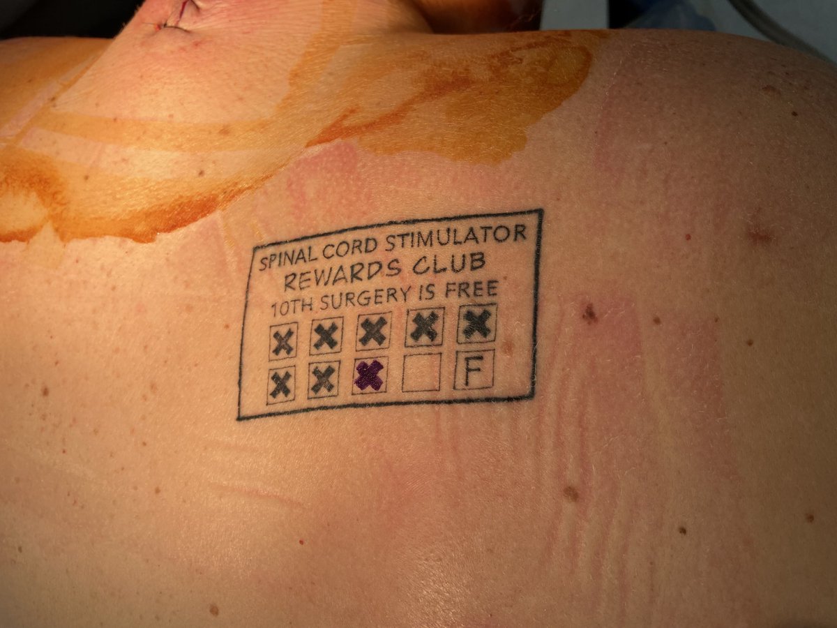 Before and after my first case today. Posted with patient’s permission. ⁦<a href="/painsection/">AANS/CNS Joint Section on Pain</a>⁩ ⁦<a href="/NANS_ION/">NANS Official</a>⁩