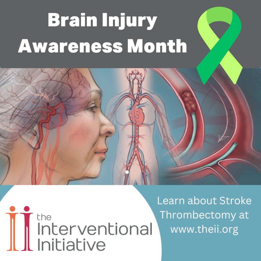 March is #BrainInjuryAwarenessMonth. The #MIIP #Stroke Thrombectomy is a minimally invasive way to treat a #Stroke. Visit the link below to learn more theii.org/stroke-thrombe…