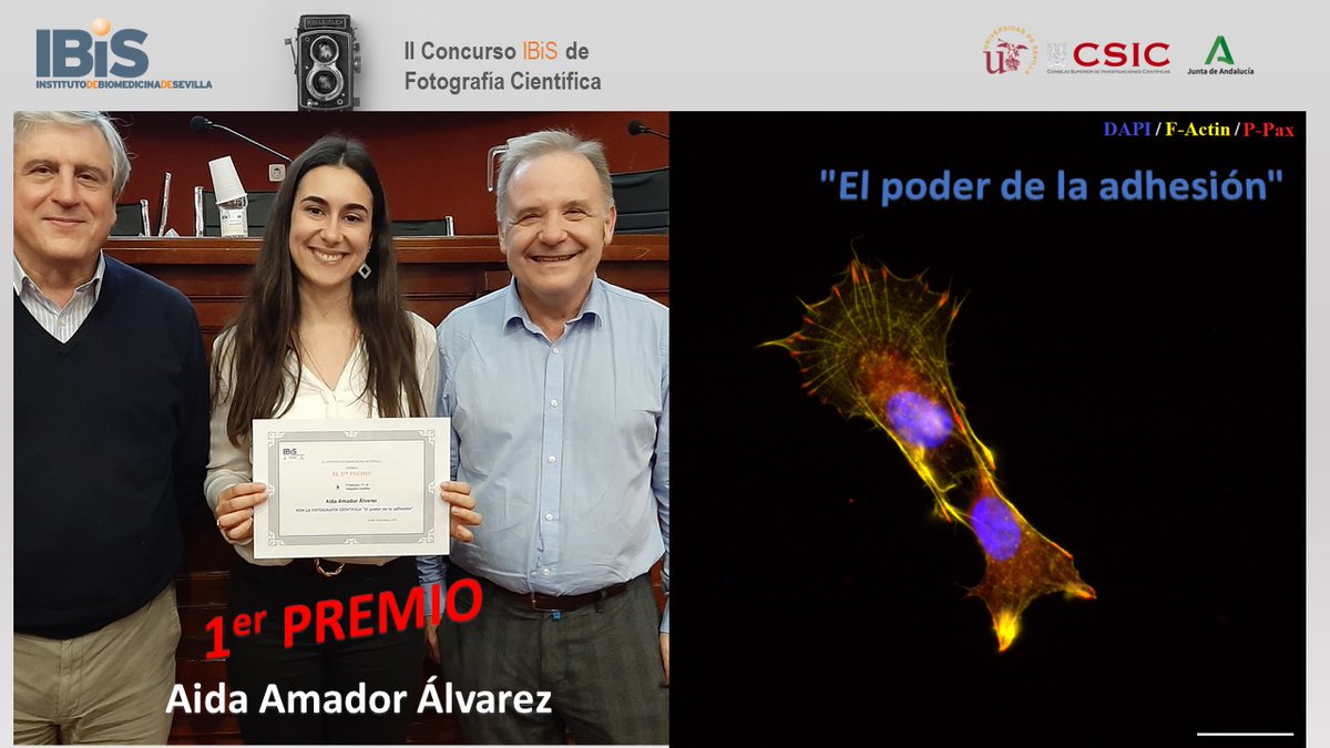 🟠  IBiS Researchers Forum 2023 | 

📸Science Photo Contest: 
🔷Congratulations to the winners 👏👏👏👇

🥇 <a href="/AidaAmadorAlv/">Aida Amador-Álvarez</a> (Group: <a href="/Pardal_Lab/">IBiS_Lab103</a>)