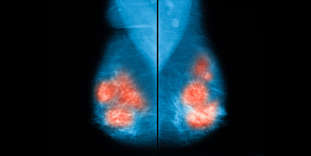 Cancer Discovery tweet media
