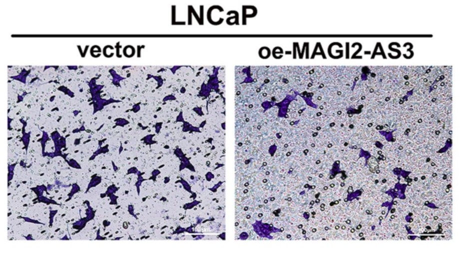 ProstateCell's tweet photo. Studies confirm that #lncRNAs are frequently altered in #CastrationResistant #ProstateCancer (PCa) and promote #DrugResistance to therapy.
Therefore, elucidating the role of lncRNAs in oncogenesis is curical for 🩺 clinical progress.
Learn more here 👉 https://t.co/ImAY80xE2M https://t.co/9sLSD1Lpjx