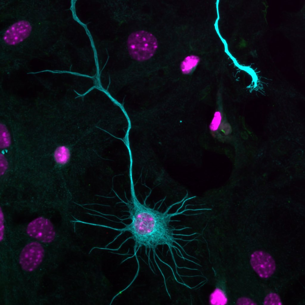 A cultured neuron for this #FluorescentFriday 🔬