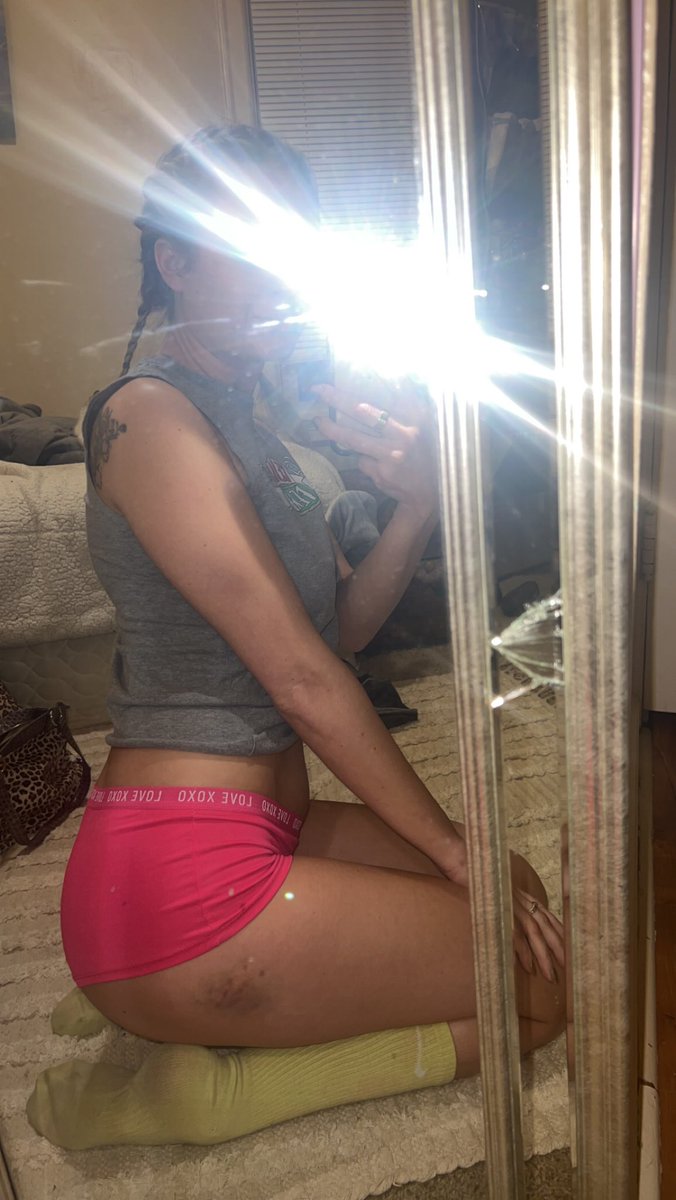 Not sure where the bruise came from so don’t ask