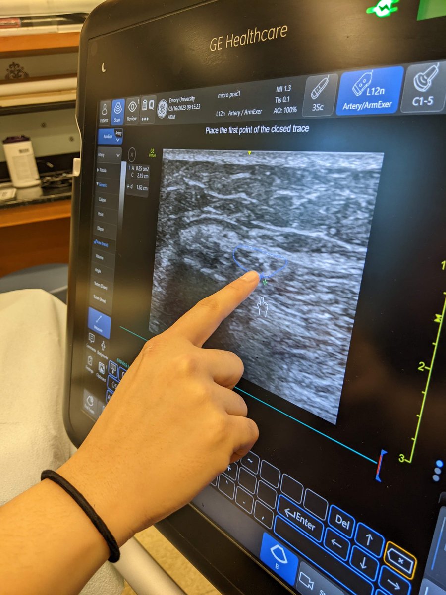 a truly amazing and lovely reunion from the UI years & a super productive training session with a true expert in the ultrasound-guided microneurography, @K_Bunsawat and an amazing team @JeannSabino, @JeanieParkMDMS,