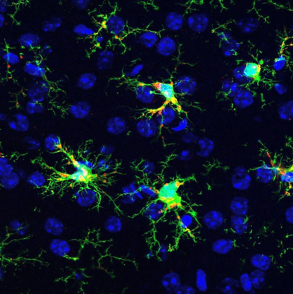 Hugo Chrost (@chrost_hugo) on Twitter photo Fluorescent picture of microglial cells after traumatic brain injury.
Credit: <a href="/Pr_Carine_Ali/">Carine Ali</a>
#neuroscience #MedTwitter Fluorescent picture of microglial cells after traumatic brain injury.
Credit: <a href="/Pr_Carine_Ali/">Carine Ali</a>
#neuroscience #MedTwitter