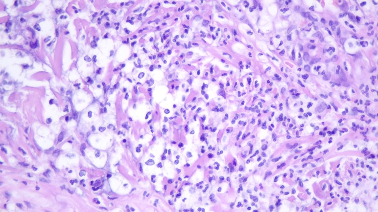 Silvija Gottesman MD on Twitter: