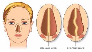wisitalia's tweet photo. La soluzione di ieri era: SETTO👃🏻
Gioca oggi con WIS‼️
✅https://t.co/DyK5UkM5Qq
#SurgeryIsWhy @me4_so @me4trauma @some4mv @me4ped @hpb_so @chirurgiafegato @yo_ifos @eahpba @gio_marchegiani @pancreasverona @youppiepancreas @acieuro @mauropodda2 @ahpba @ielpob @drfrancescopata https://t.co/jjJybEQytK