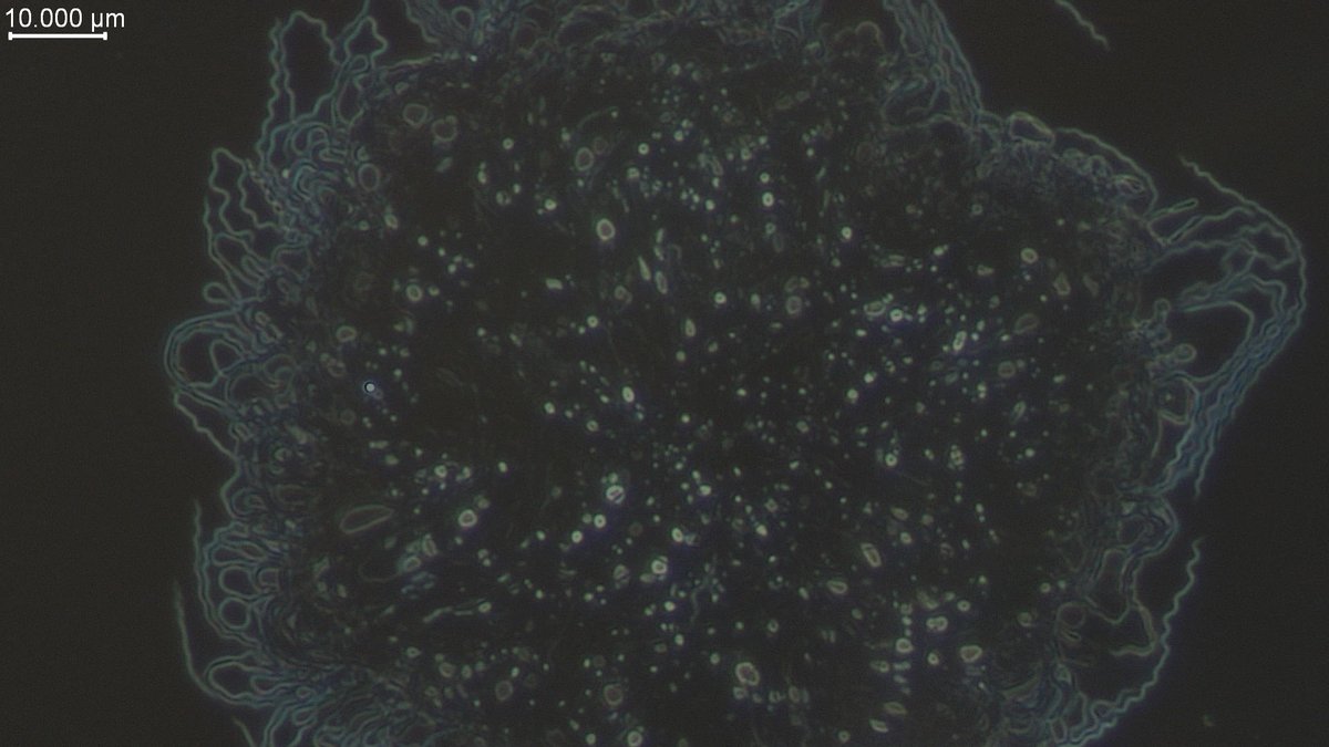 ackrusen's tweet photo. Microscopy means pretty pictures. I am always amazed by what Borrelia shows me. #spirochete #microbiology https://t.co/FwKvqrcsBe