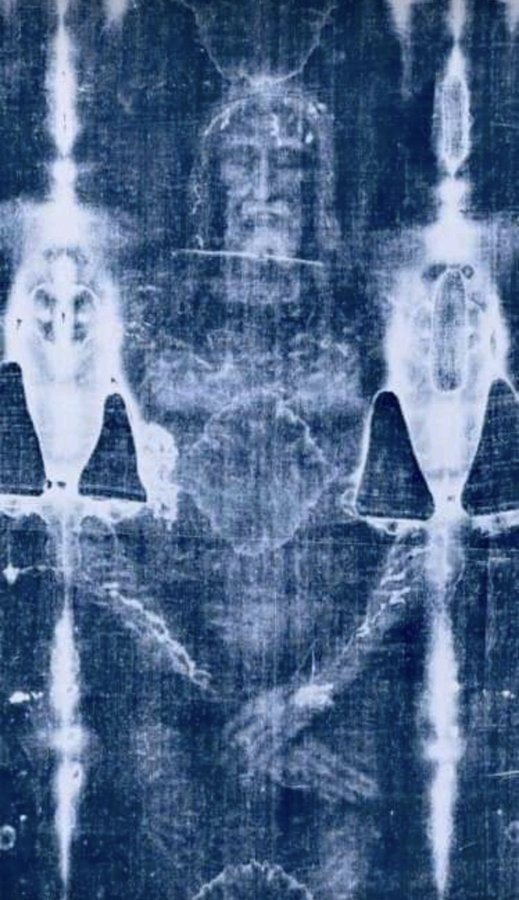 The blood on the Shroud is identical to the blood found on the Sudarium, as well as in all the Eucharistic miracles that have been tested by science. The blood from the Shroud, the Sudarium, and the Eucharist all come from a tortured man.