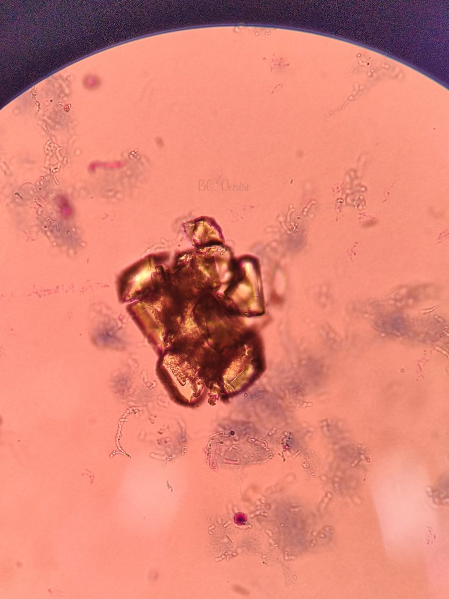 Denisetobacter's tweet image. Cristales de Ácido Úrico en orina 🔬
40x