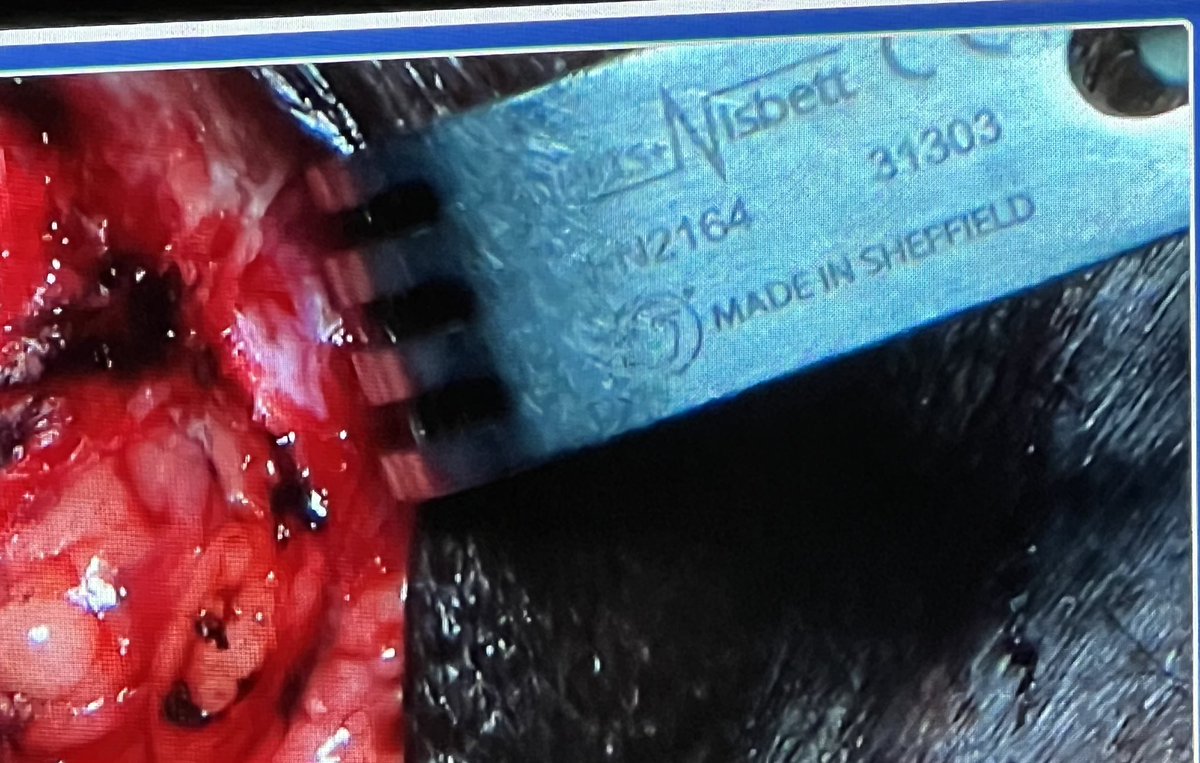 khizzy147's tweet photo. Good old Sheffield steel! @OliverBrown147 @AcHugill @ChrisKeogan123 @lfc_wozz @OldhamSnooker @SheffCouncil #isoru23 #urethroplasty #sheffiled #sheffieldsteel https://t.co/ACWZk8ZVW9
