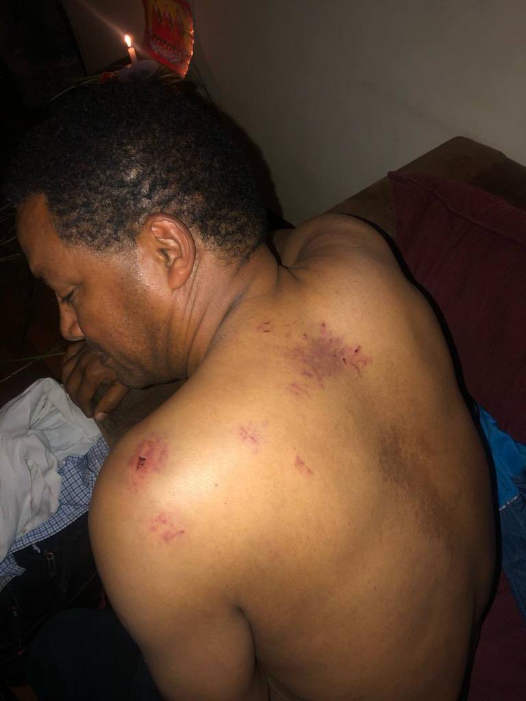 NeaminZeleke's tweet photo. ንጉሴን ሳይገድሉ torture አድርገው የጣሉት ልሎችን ሚድያ ለማሸማቀቅ ነው! ይህ ነው ያስደበደበው!!
https://t.co/whwMcKqsjX https://t.co/wBaFbiKJRG