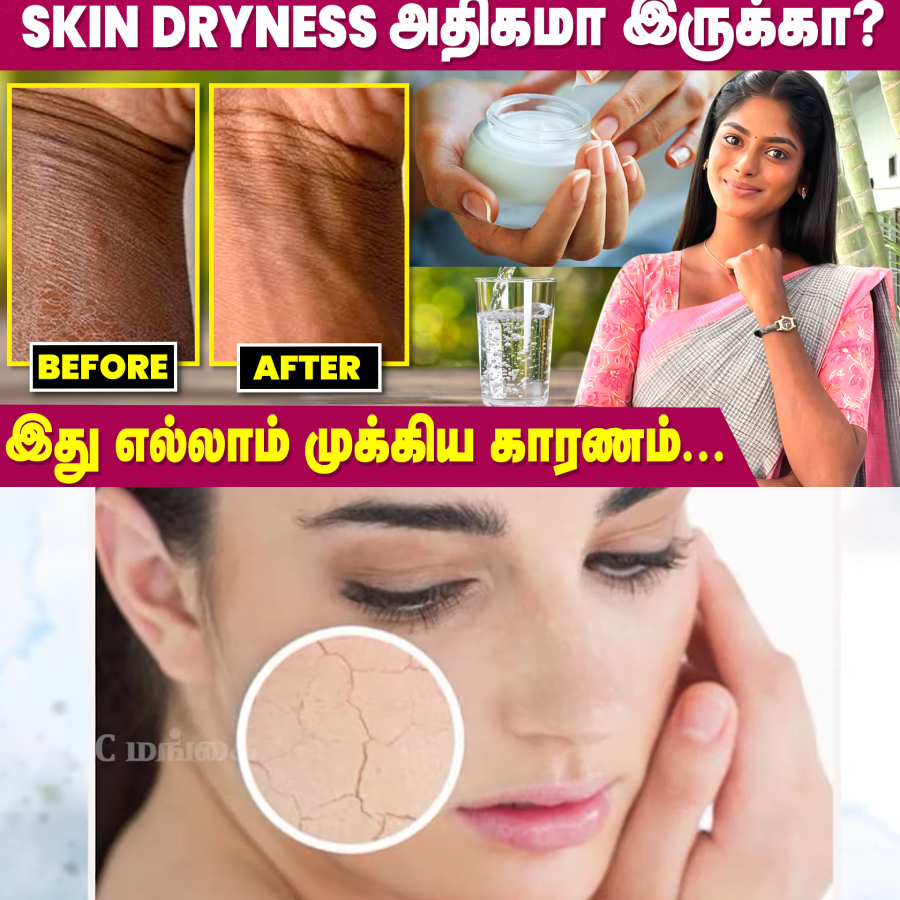 Causes of Skin Dryness | Easy Ways to get rid of Skin Dryness | Skin Care | IBC Mangai

WATCH NOW -- youtu.be/jxdFTuMTPjw

#skindryness #skincare #dryskin #dryskincare #ibcmangai