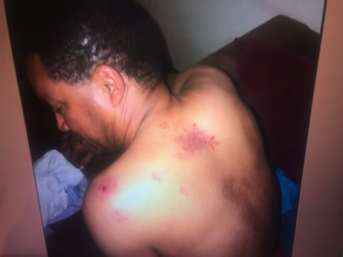 EcnasT's tweet photo. Ethiopian security forces kidnap and beat unconscious Nigussie Berhanu -politician, analyst, and gov't critic at Yegna TV. @SecBlinken @ABlinken @EthioHRC @StateDeptSpox @AsstSecStateAF @AP @AFPAfrica @nytimes @ReutersAfrica @NeaminZeleke @LindaT_G @CPJAfrica @amnesty https://t.co/6JOwfrt8bx