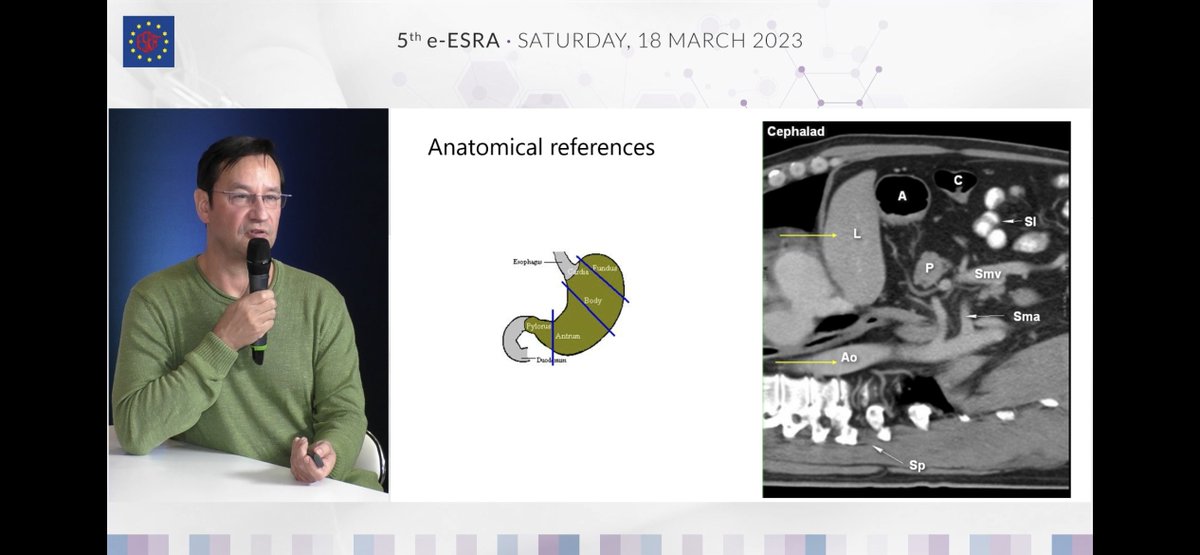 claralexlobo's tweet photo. POCUS session - save lives, says @Steve_Coppens 
death still occurs after gastric aspiration!
Gastric US - What info?
gastric content type &amp; volume amount
Anatomical references
bullseye sign = empty stomach
foster glass = food early stage
Distended antrum =food late stage https://t.co/TLFx5MF2bg