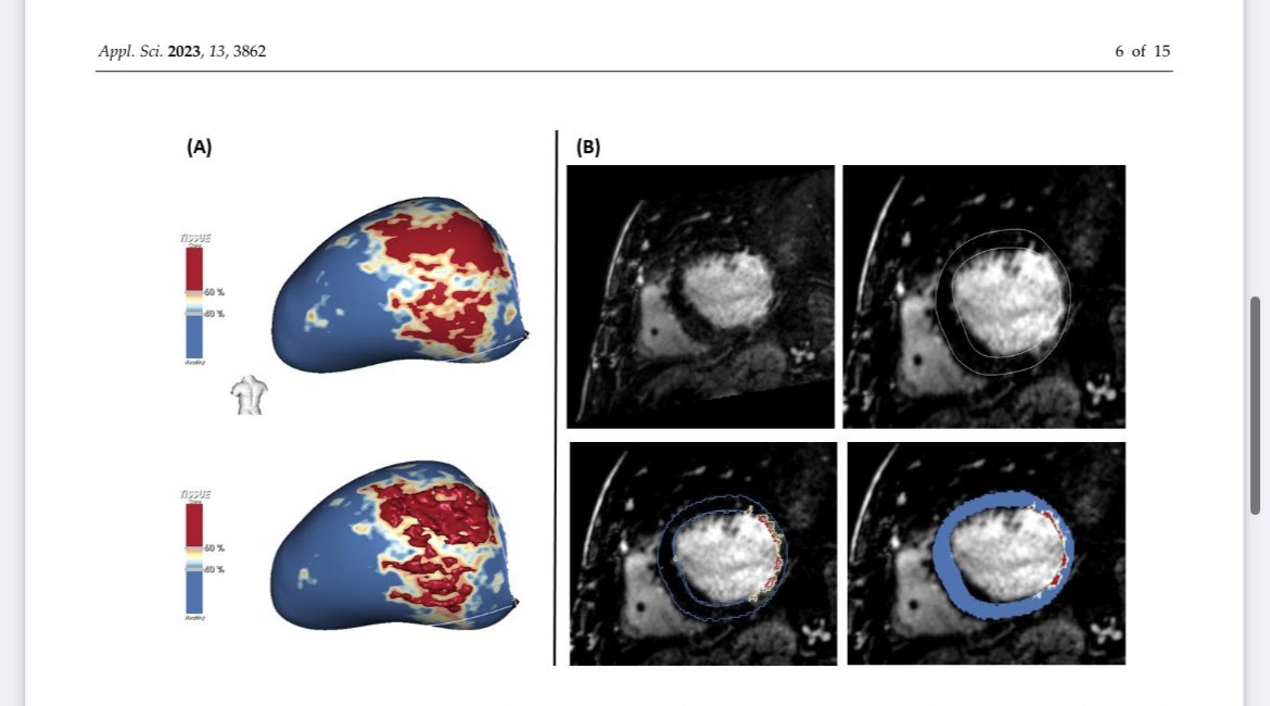Check our review article ( mdpi-res.com/d_attachment/a… ) about the role of MRI in the EP lab by our BEng Paz Garre and <a href="/ElisendaFerro/">Elisenda Ferró</a> and our EPs <a href="/S_Vazquez_Calvo/">Sara Vázquez</a> and <a href="/TillAlthoff/">Till Althoff</a> <a href="/hospitalclinic/">Hospital Clínic</a>