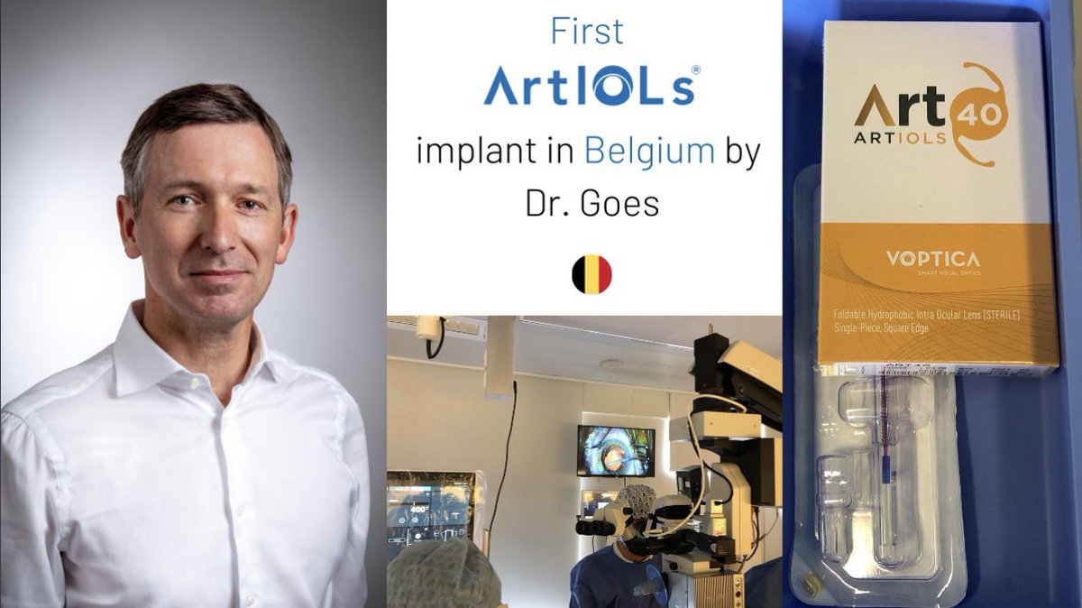 Voptica's tweet photo. First #ArtIOLs implant in Belgium π§πͺππ
#Ophthalmology
#Peripheralvision
#Invertedmeniscus
#DrGoes https://t.co/oTRsHKHiLK