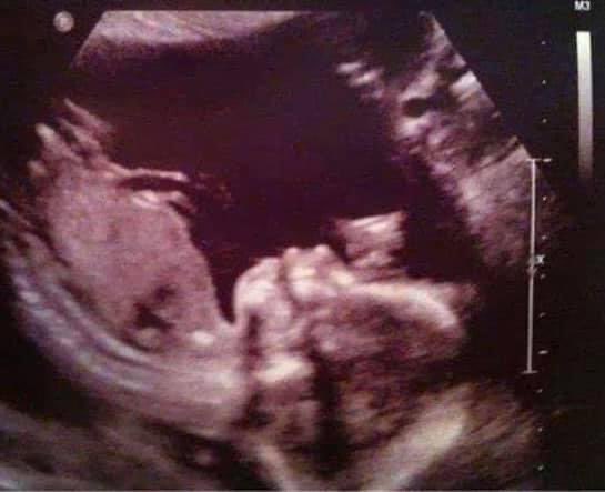 Lovely news.
One of our neighbours is expecting her first baby and apparently, a cat as well...

#caturday #caturdayvibes #Liverpool #shopping #food