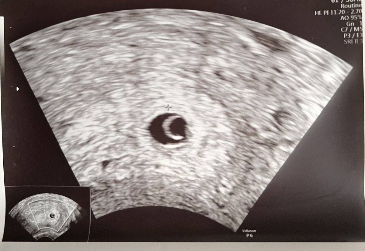 #infertilpandy esto es lo k vi ayer😍