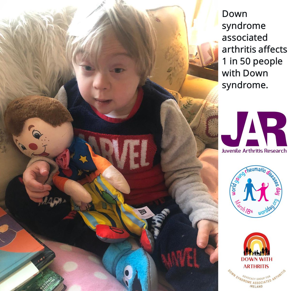 This is Jack. Jack has Down syndrome associated arthritis. He is a full time wheelchair user and has never walked. He is non verbal so cannot say where/ when he hurts. Thanks to the wonderful Doctors @CHIatCrumlin who are leaders in this area after having done vast research.