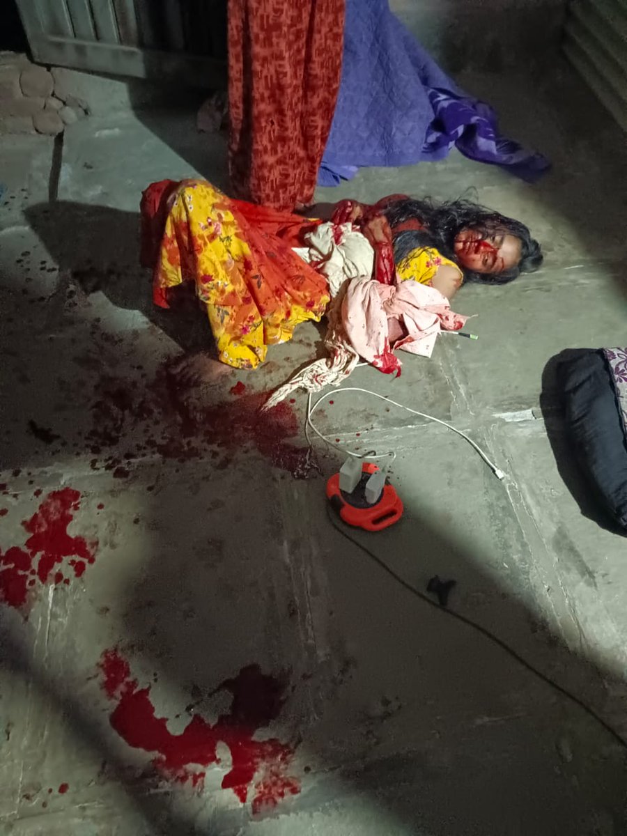 rautsanjay61's tweet photo. देवेंद्रजी.हे चित्र बार्शीतले आहे..
 मुलगी तुमच्या कुटुंबातील नाही म्हणून तिचे रक्त वाया जाऊ देऊ नका.भाजपा पुरस्कृत गुंडांनी हा जीवघेणा हल्ला केला आहे. अल्पवयीन मुलगी पारधी समाजाची आहे.गरिबांच्या मुली रस्त्यावर पडल्या आहेत ?५ मार्चला हल्ला झाला
 आरोपी मोकाट आहेत.
@Dev_Fadnavis https://t.co/E5Bef1sDPb
