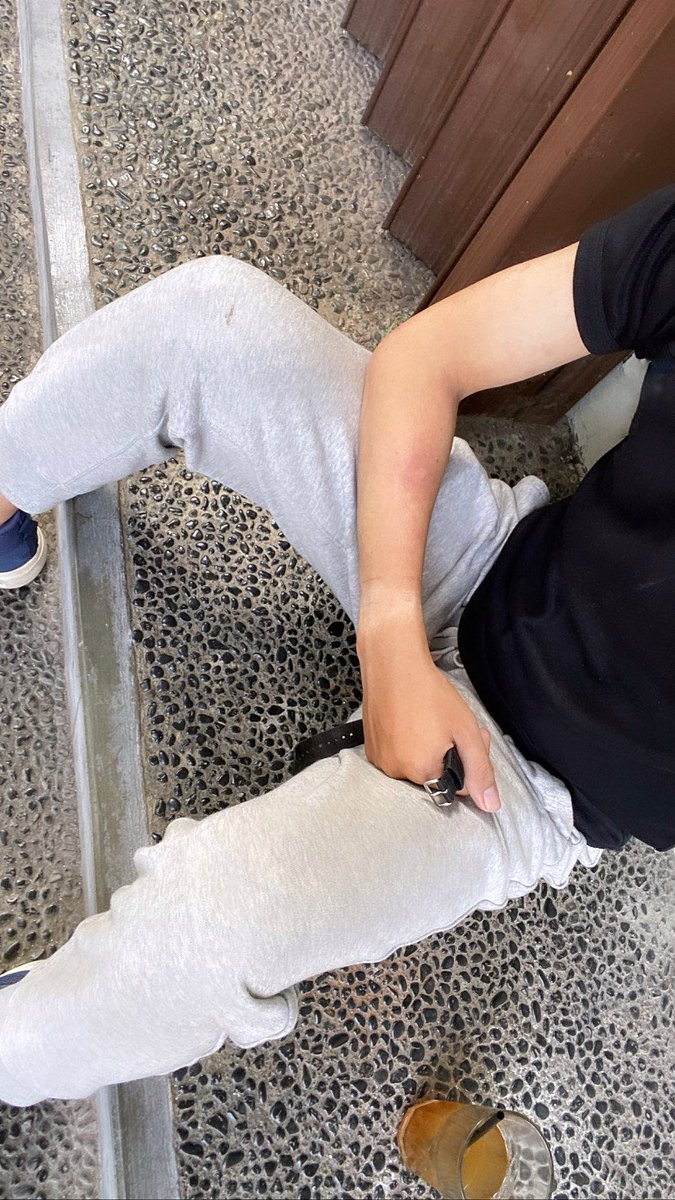 ericklyz's tweet photo. lari sore dapet bonus belang bentol https://t.co/aUqGlNmplp