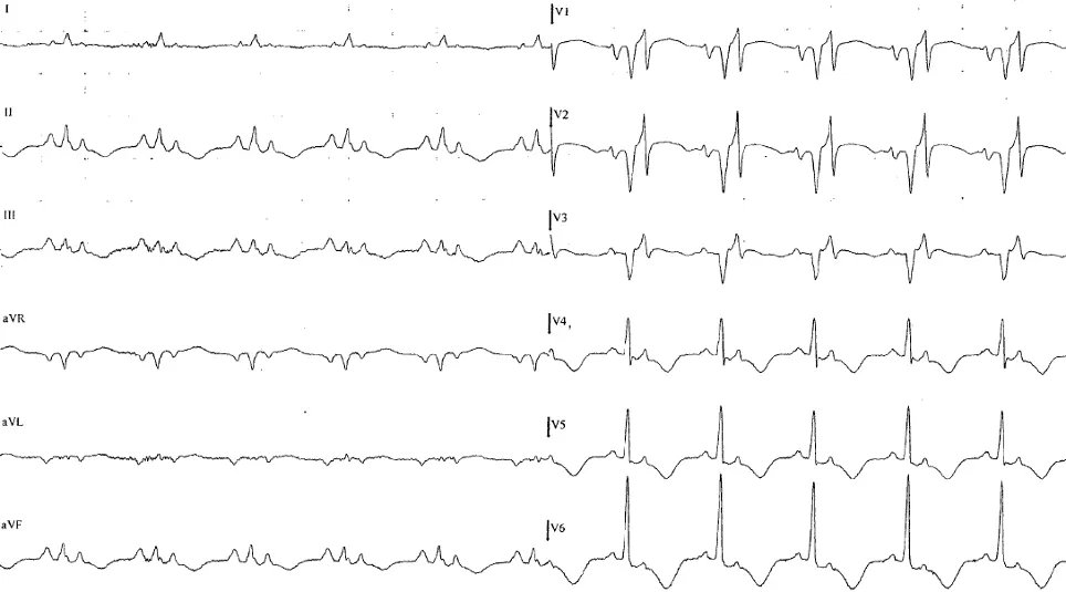 Italian Cardiologists Of Tomorrow tweet media