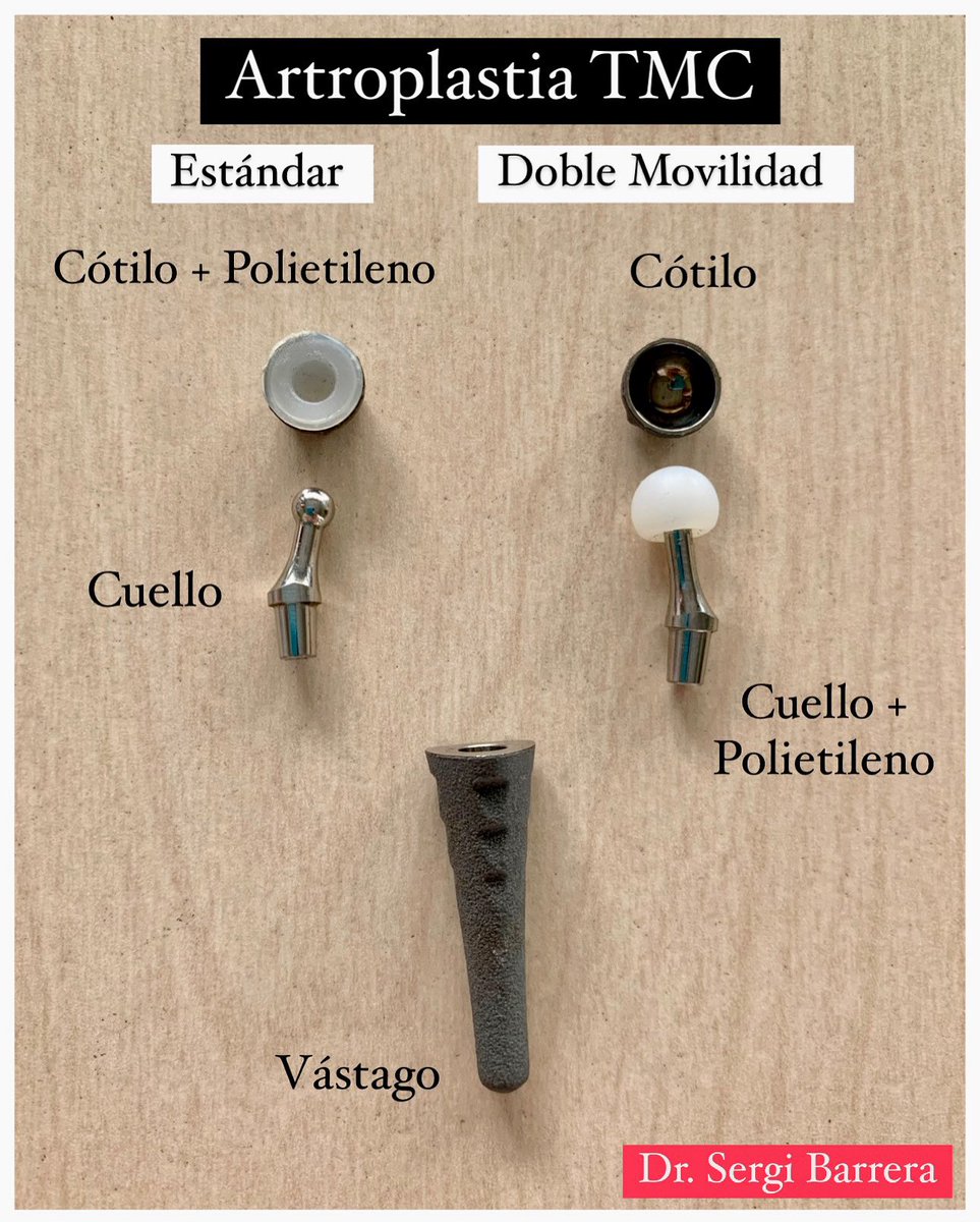 ▪️Sabes cuáles son las diferencias entre las prótesis trapecio-metacarpianas y las estándar?
▪️Escribe tus preguntas en comentarios y las resolvemos!

▪️Do you know what the differences are between trapezium-metacarpal arthroplasties and standard ones?