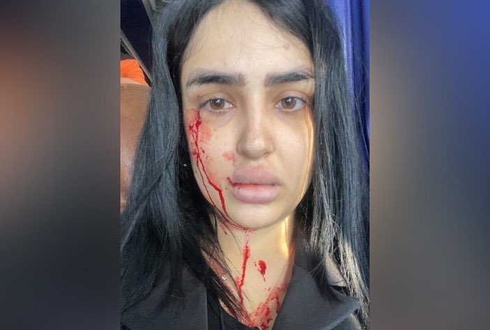 Her name is #ShirinNajafi. Her dear sister, #HadisNajafi, was brutally killed by the Islamist regime in Iran for protesting. 

Now, the regime threatened to sentence Shirin to 15-25 years if she doesn’t collaborate.

They don’t even let mourning families breathe.