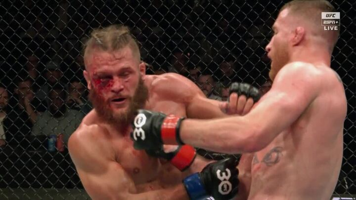 espnmma's tweet photo. FIZIEV'S EYE 😨 #UFC286 https://t.co/W7IJROYg4W