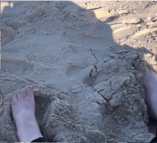 CPAPProtection's tweet image. How long before Chantal’s ankles look like ALR’s?
#FoodieBeauty