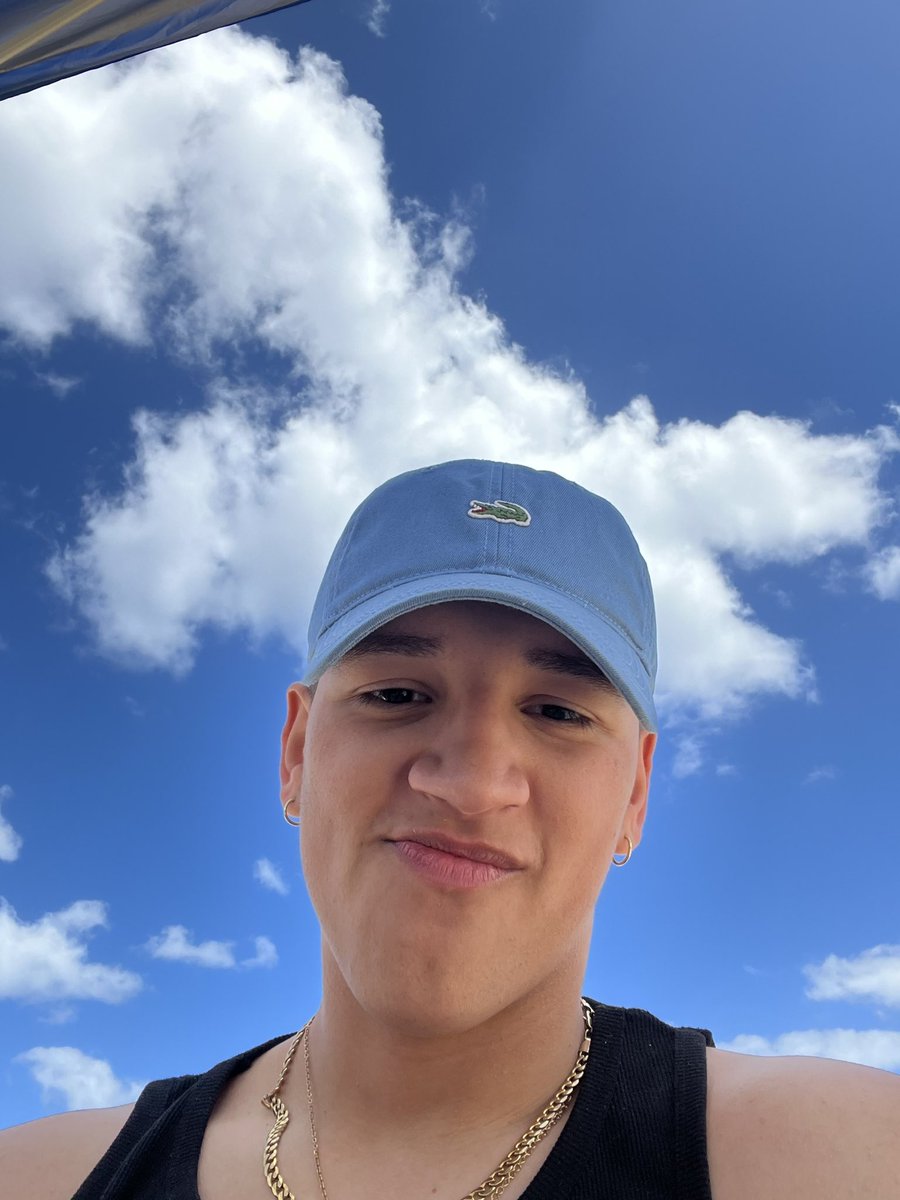 gxdriel's tweet photo. antes y después de coger un poquito de ☀️ https://t.co/Xs8rANmpPc
