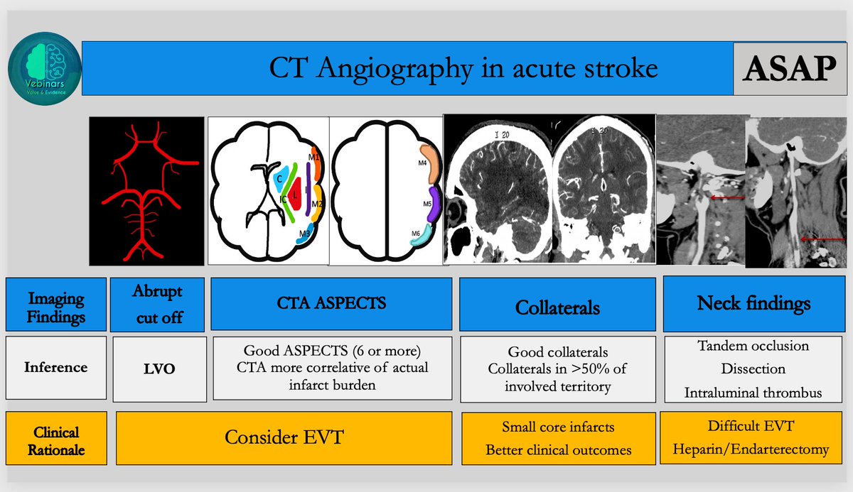 vebinars_neuro's tweet photo. 🔵CT Angiography in acute stroke-ASAP formats
https://t.co/YOexKtv6t2

#value_based_imaging #Vebinars #evidence_based_medicine #Neuroimaging #NeuroRad  #Neurology #stroke #FOAMrad #FOAMed #neurotwitter https://t.co/PLHPIhFNAc
