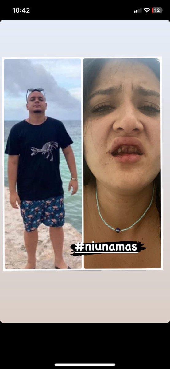 MayalejaM23's tweet photo. Maldito cerdo y esta no es ni la primera vez ni la primera mujer que le pega, a la primera hablen siempre 🥺 https://t.co/CsE2Rgxli8