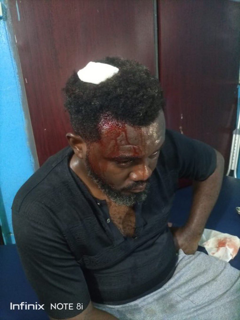 prudenceoflago3's tweet photo. More pictures of election violence victims that are still in the hospital, we pray they survive😭😭💔....

MC oluomo and co won't escape God's wrath😭💔

Ikpeazu Ladi Adebutu Alex Otti Gbadebo Rhodes kaduna MC oluomo Lagos Abia state Usman Rivers #electionresults2023
Wike Kano https://t.co/Q7RUemeoEE