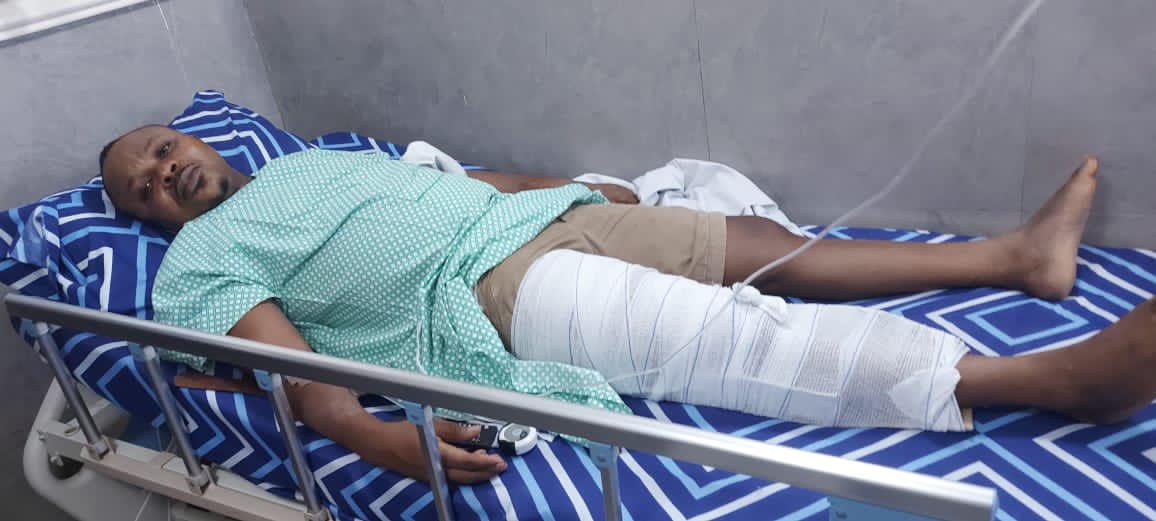 prudenceoflago3's tweet photo. More pictures of election violence victims that are still in the hospital, we pray they survive😭😭💔....

MC oluomo and co won't escape God's wrath😭💔

Ikpeazu Ladi Adebutu Alex Otti Gbadebo Rhodes kaduna MC oluomo Lagos Abia state Usman Rivers #electionresults2023
Wike Kano https://t.co/Q7RUemeoEE